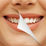 Как выполняется отбеливание зубов?