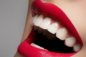 Технологии отбеливания зубов