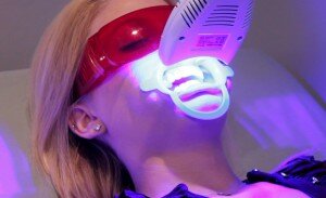 Технологии отбеливания зубов