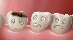 Не стоит пренебрегать посещением стоматолога-терапевта