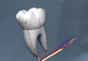 Воспаление или повреждение нервной ткани зуба