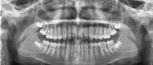 Рентгенологическое исследование зубов