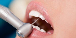 Стоимость гемисекции в стоматологии «ДентаЛюкс-М»