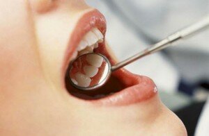 Как выполняется снятие зубных украшений?