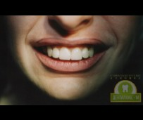 До и после протезирования зубов металлокерамикой